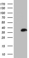 HEK293T cells were transfected with the pCMV6-ENTRY control (Left lane) or pCMV6-ENTRY ASPA (Right lane) cDNA for 48 hrs and lysed. Equivalent amounts of cell lysates (5 ug per lane) were separated by SDS-PAGE and immunoblotted with anti-ASPA.