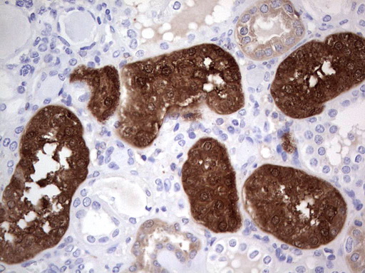 IHC of paraffin-embedded Human Kidney tissue using anti-ASPA mouse monoclonal antibody. (Heat-induced epitope retrieval by 1 mM EDTA in 10mM Tris, pH8.5, 120°C for 3min).