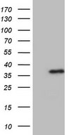 HEK293T cells were transfected with the pCMV6-ENTRY control (Left lane) or pCMV6-ENTRY ASPA (Right lane) cDNA for 48 hrs and lysed. Equivalent amounts of cell lysates (5 ug per lane) were separated by SDS-PAGE and immunoblotted with anti-ASPA.