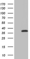 HEK293T cells were transfected with the pCMV6-ENTRY control (Left lane) or pCMV6-ENTRY ASPA (Right lane) cDNA for 48 hrs and lysed. Equivalent amounts of cell lysates (5 ug per lane) were separated by SDS-PAGE and immunoblotted with anti-ASPA.