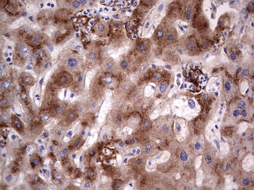 IHC of paraffin-embedded Human liver tissue using anti-ASPA mouse monoclonal antibody. (Heat-induced epitope retrieval by 1 mM EDTA in 10mM Tris, pH8.5, 120°C for 3min).