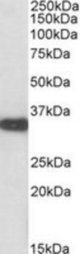 ASPA antibody (0.01 ug/ml) staining of Mouse Kidney lysate (35 ug protein/ml in RIPA buffer). Primary incubation was 1 hour. Detected by chemiluminescence.