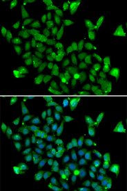 Immunofluorescence blot of MCF7 cell using ASPA antibody. Blue: DAPI for nuclear staining.