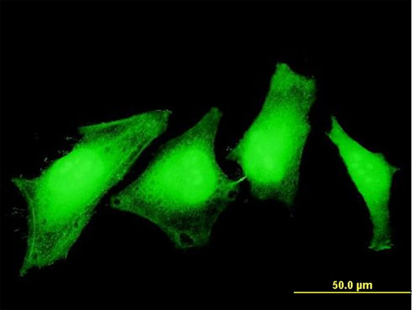 Immunofluorescence of monoclonal antibody to ASPA on HeLa cell . [antibody concentration 10 ug/ml]