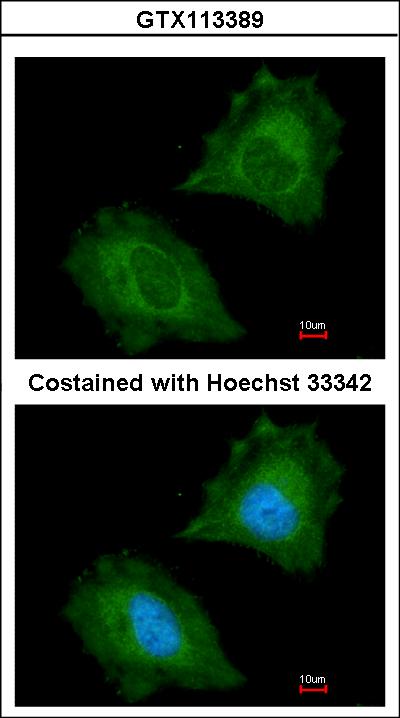 Immunofluorescence of paraformaldehyde-fixed HeLa using Aspartoacylase antibody at 1:200 dilution.