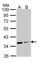 Sample (30 ug of whole cell lysate). A: Molt-4 , B: Raji. 10% SDS PAGE. ASPA antibody diluted at 1:1000.