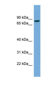CRTAC1 antibody LS-C116664 Western blot of HepG2 cell lysate.