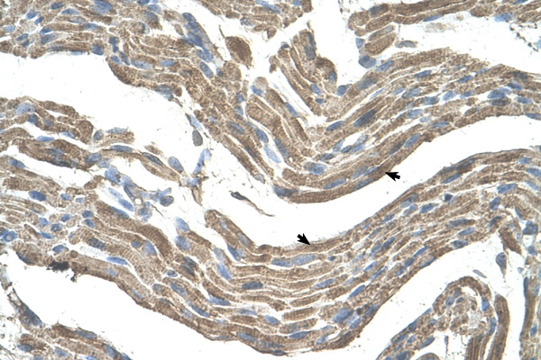 ASPN / Asporin antibody LS-C31930 IHC of formalin-fixed, paraffin-embedded human Muscle. Positive label: Skeletal muscle cells indicated with arrows. Antibody concentration 4-8 ug/ml. Magnification 400X.