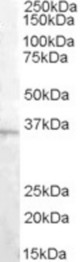 Antibody (1.5 ug/ml) staining of Human Testis lysate (35 ug protein in RIPA buffer). Primary incubation was 1 hour. Detected by chemiluminescence.