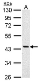 ASS1 antibody detects ASS1 protein by Western blot analysis. A. 30 ug A431 whole cell lysate/extract. 10 % SDS-PAGE. ASS1 antibody dilution:1:1000