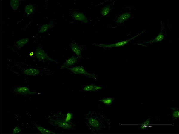Immunofluorescence of monoclonal antibody to ASS1 on HeLa cell . [antibody concentration 10 ug/ml]