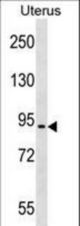 ASTE1 Antibody western blot of Uterus tissue lysates (35 ug/lane). The ASTE1 antibody detected the ASTE1 protein (arrow).