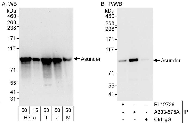 Detection of Human and Mouse Asunder by Western Blot (h and m) and Immunoprecipitation (h). Samples: Whole cell lysate from HeLa (15 and 50 ug for WB; 1 mg for IP, 20% of IP loaded), 293T (T; 50 ug), Jurkat (J; 50 ug) and mouse NIH3T3 (M; 50 ug) cells. Antibodies: Affinity purified rabbit anti-Asunder antibody used for WB at 0.04 ug/ml (A) and 0.4 ug/ml (B) and used for IP at 6 ug/mg lysate. Asunder was also immunoprecipitated by rabbit anti-Asunder antibody BL12728, which recognizes an upstream epitope. Detection: Chemiluminescence with exposure times of 30 seconds (A) and 10 seconds (B).