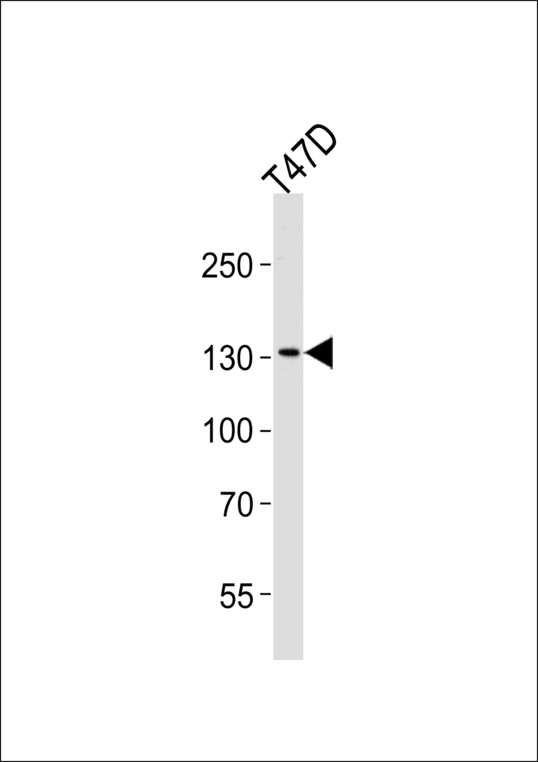 Western blot of lysate from T47D cell line, using ATAD2 Antibody. Antibody was diluted at 1:1000 at each lane. A goat anti-rabbit IgG H&L (HRP) at 1:5000 dilution was used as the secondary antibody. Lysate at 35ug.