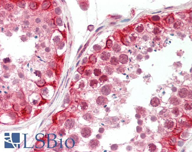 Anti-ATAD2 antibody IHC staining of human testis. Immunohistochemistry of formalin-fixed, paraffin-embedded tissue after heat-induced antigen retrieval. Antibody LS-B9767 concentration 5 ug/ml.