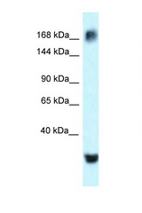 ATAD2 antibody Western blot of MCF7 Cell lysate. Antibody concentration 1 ug/ml.