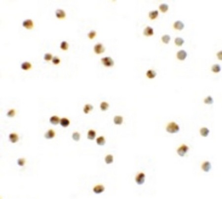 Immunocytochemistry of ATAD3A in Daudi cells with ATAD3A antibody at 20 ug/ml.