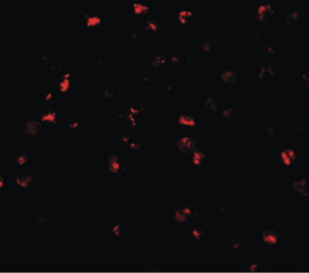 Immunofluorescence of ATAD3A in Daudi cells with ATAD3A antibody at 20 ug/ml.