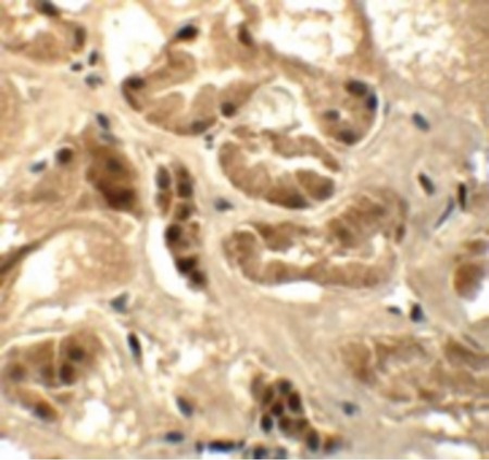 Immunohistochemistry of ATAD3B in human kidney tissue with ATAD3B antibody at 5 ug/ml.