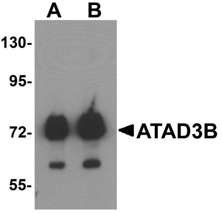 Western blot analysis of ATAD3B in human kidney tissue lysate with ATAD3B antibody at (A) 1 and (B) 2 ug/ml .