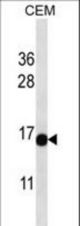 ATAD4 Antibody western blot of CEM cell line lysates (35 ug/lane). The ATAD4 antibody detected the ATAD4 protein (arrow).