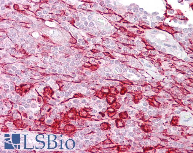Anti-ATF1 antibody IHC of human thymus. Immunohistochemistry of formalin-fixed, paraffin-embedded tissue after heat-induced antigen retrieval. Antibody LS-B6733 concentration 5 ug/ml.