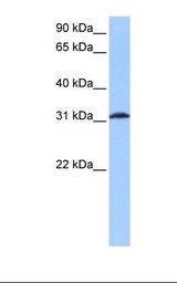 721_B cell lysate. Antibody concentration: 0.5 ug/ml. Gel concentration: 12%.