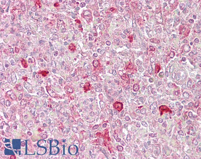 Anti-ATF1 antibody IHC of human spleen. Immunohistochemistry of formalin-fixed, paraffin-embedded tissue after heat-induced antigen retrieval. Antibody LS-B6808 concentration 5 ug/ml.