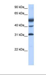 Placenta cell lysate. Antibody concentration: 0.5 ug/ml. Gel concentration: 12%.
