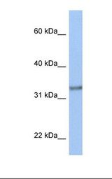 MCF7 cell lysate. Antibody concentration: 1.0 ug/ml. Gel concentration: 12%.