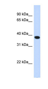 ACBD4 antibody LS-C102346 Western blot of Transfected 293T cell lysate.