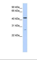 Fetal brain lysate. Antibody concentration: 1.0 ug/ml. Gel concentration: 12%.