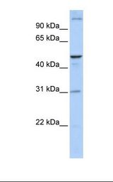 Fetal brain lysate. Antibody concentration: 1.0 ug/ml. Gel concentration: 12%.