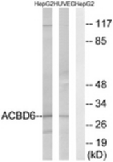Western blot of extracts from HepG2/HUVEC cells, using ACBD6 Antibody. The lane on the right is treated with the synthesized peptide.