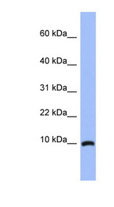 ACBD7 antibody LS-C111866 Western blot of Fetal Brain lysate.