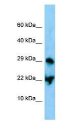 ATF3 antibody Western Blot of Mouse Stomach.