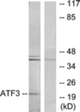 Western blot of extracts from RAW264.7 cells, using ATF3 Antibody. The lane on the right is treated with the synthesized peptide.