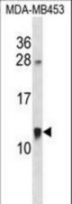 ACBD7 Antibody western blot of MDA-MB453 cell line lysates (35 ug/lane). The ACBD7 antibody detected the ACBD7 protein (arrow).