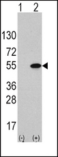 Western blot of ATF4 (arrow) using rabbit anti-ATF4 Antibody (S245). 293 cell lysates (2 ug/lane) either nontransfected (Lane 1) or transiently transfected with the ATF4 gene (Lane 2) (Origene Technologies).