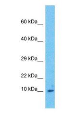 Western blot of ACBD7 Antibody with human Stomach Tumor lysate.
