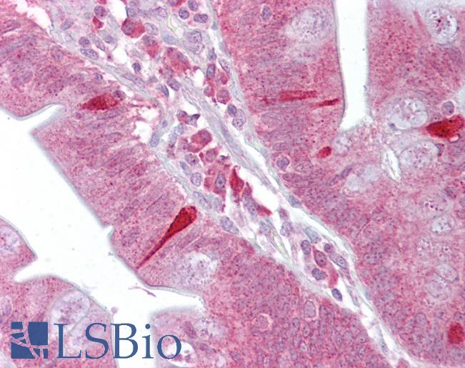 Anti-ATF4 antibody IHC of human small intestine. Immunohistochemistry of formalin-fixed, paraffin-embedded tissue after heat-induced antigen retrieval. Antibody LS-B6806 concentration 5 ug/ml.
