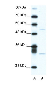 ATF4 antibody LS-C30544 Western blot of Jurkat lysate.