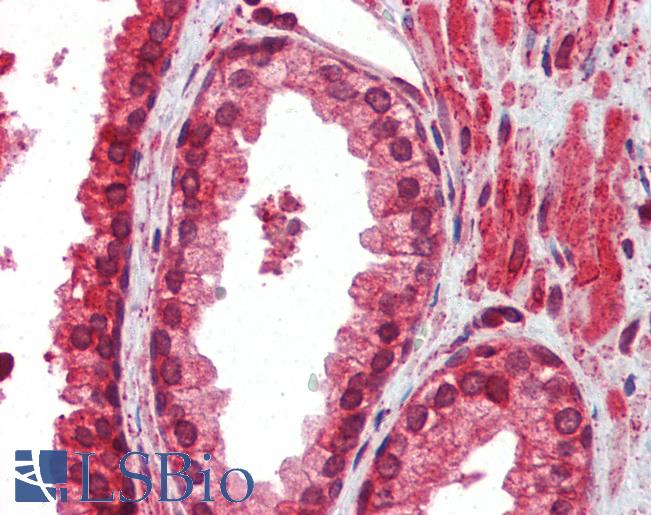 Anti-ATF4 antibody IHC of human prostate. Immunohistochemistry of formalin-fixed, paraffin-embedded tissue after heat-induced antigen retrieval. Antibody LS-B3517 concentration 5 ug/ml.