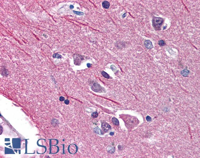 Anti-ACCN1 antibody IHC of human brain, cortex. Immunohistochemistry of formalin-fixed, paraffin-embedded tissue after heat-induced antigen retrieval. Antibody LS-B156 concentration 5 ug/ml.
