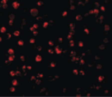Immunofluorescence of ATF6 in MCF7 cells with ATF6 antibody at 10 ug/ml.
