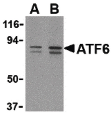 Western blot of ATF6 in MCF7 cell lysate with ATF6 antibody at (A) 0.5 and (B) 1 ug/ml.