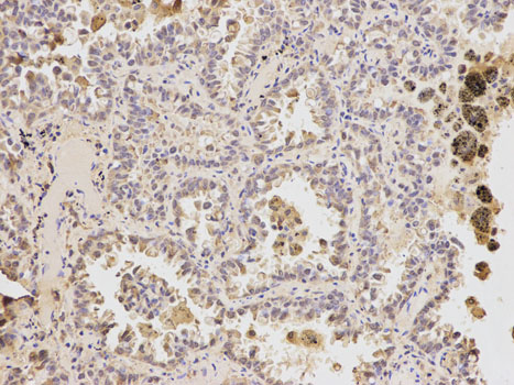 Immunohistochemistry of paraffin-embedded rat lung using ATF6 antibody at dilution of 1:200 (200x lens).