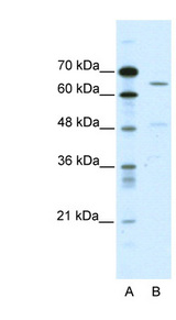 ACCN1 antibody LS-B156 Western blot of HepG2 cell lysate.