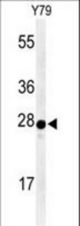 Western blot of AANAT Antibody in Y79 cell line lysates (35 ug/lane). AANAT (arrow) was detected using the purified antibody.