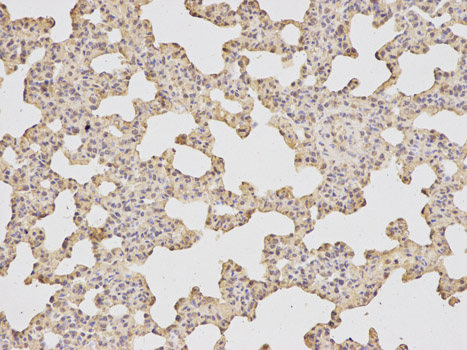 Immunohistochemistry of paraffin-embedded human lung using ATF6 antibody at dilution of 1:200 (200x lens).